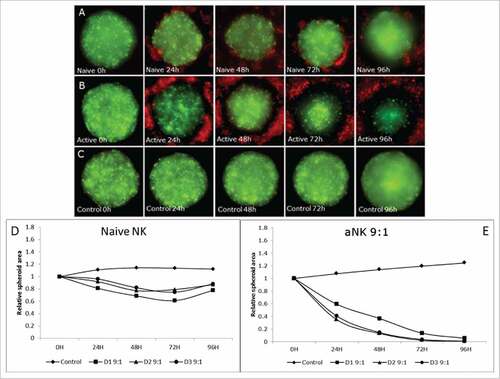 Figure 3. Cytotoxic effect of NK R69-LCL activated cells on HCT116 spheroid compared with naïve NK cells at high e:t ratio. (A, B and C) Fluorescent images of HCT116 cells (green) and NK cells (red) in a high e:t ratio during 96 hours treatment. Area evolution of CRC spheroids after treatment with nNK (A), activated NK cells (B), and control group with no NK presence (C). (D,E) A representative experiment from at least three experiments performed with 3 different donors is shown. The relative spheroid area was measured (D) Naïve nNK cells were able to reduce partially the tumour size but after 72h, spheroids star to grow and no clear effect is observed after 96h. (E) Activated NK cells at high e:t ratio are able to diminish drastically CRC spheroid size until almost complete elimination of GFP signal expressed by CRC cells.