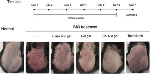 Figure 2 Psoriatic symptoms on the dorsal skin of mice after IMQ and different formulations (n=6).