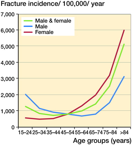 Figure 2. Incidence of fractures per 100,000 population, according to sex.