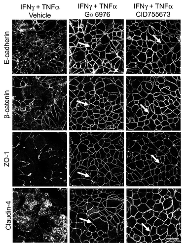 Figure 8. PKD mediates cytokine-induced disassembly of pancreatic epithelial junctions. HPAF-II cells were treated for 48 h with IFNγ plus TNFα in the presence of either vehicle or two different pharmacological inhibitors of PKD, Gö 6976 (10 µM) and CID755673 (50 µM). Localization of AJ and TJ proteins E-cadherin, β-Catenin, ZO-1 and claudin-4 was determined by fluorescence labeling and confocal microscopy. Both PKD inhibitors prevent IFNγ/ TNFα induced AJ and TJ disassembly (arrows). Bar, 20 µm.