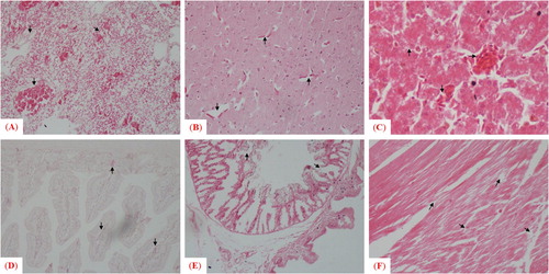 Figure 6. Microscopic examination of histopathologic changes in different tissues collected from pigeons infected with the mesogenic strain. Arrows indicate histologic and pathologic lesions in (A) lung, (B) brain, (C) liver, (D) small intestine, (E) gizzard and (F) heart.