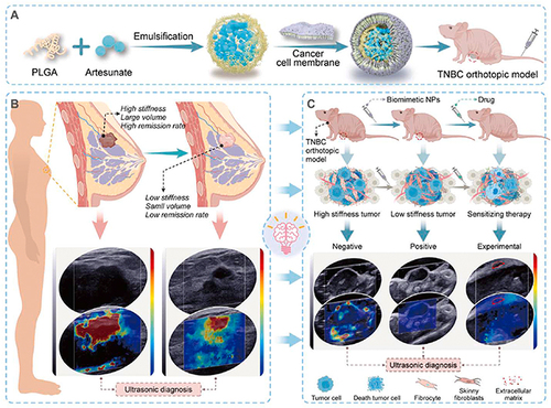 Figure 7 Schematic of the (A) preparation of CCM-NP and (B and C) discussion on the mechanism of predicting TNBC tumor treatment efficacy using shear wave elastography.