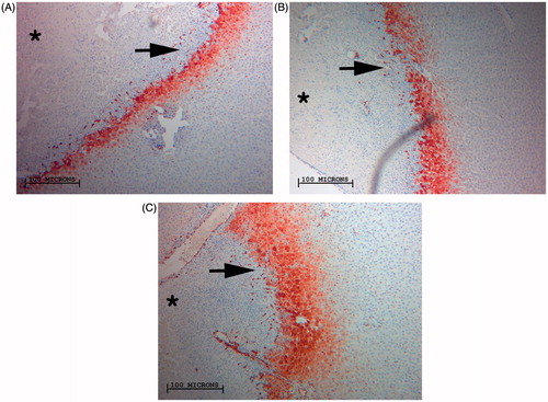Figure 3. Comparison of RF-induced peri-ablational Hsp70 in normal rat liver for varied RF application. Magnified images (10×) of liver peri-ablational rims stained for Hsp70 expression after 2 min (A), 5 min, (B), and 10 min (C) for a standardised RF tip temperature (90 °C) demonstrates a significant increase in rim thickness when increasing duration of RF application (p < 0.003). By contrast, incremental increase of tip temperature at any constant application period did not result in significant increases in Hsp70 expression (p < 0.4).