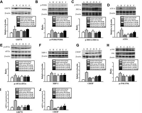 Figure 6 Didymin reduced ERS by inhibiting the relevant signaling pathways. (A–H) The protein expression of GRP78, PERK, IRE1α, ATF 6, eIF2α, XBP-1, CHOP and JNK was detected by Western blotting; bands 1–6 represent the normal group, model control group, 4PBA group, and didymin-treated groups (2, 1 and 0.5mg/kg), respectively; (I and J) The mRNA levels of GRP78 and CHOP were detected by RT-PCR. #P<0.05 VS the normal group and *P<0.05 VS the CCl4 model group.