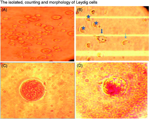 Figure 2. A (the isolated Leydig cells of male rat staining with Neutral red), B (counting the Leudig cells by Neubauer chamber (Asterisks; Adult Leydig cells, Thin arrow; Aging Leydig cell, Bold arrow; Premature Leydig-like cell) Olympus microscopic (10×), C and D (Alive and Dead adult Leydig cell stained by Neutral Red).