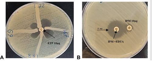 Figure 1 (A) Modified Hodge Test; Positive result appeared as a cloverleaf-like indentation of the zone of inhibition of the E. coli ATCC 25922 (indicator organism) along with the streak of inoculum. (B) Combined Disk Test; An inhibition zones with ≥ 17 mm in the inhibition zone diameter of EDTA-containing imipenem disc compared to imipenem disc alone was a positive MBL producer. The negative result appeared as no difference in the zones diameter around the two discs.