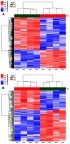 Figure 4 (A) Hierarchical clustering analysis of 1085 differentially expressed lncRNA probe sets. (B) Hierarchical clustering analysis of 227 differentially expressed mRNA probe sets. The samples are in the columns, and the probe sets are in the rows.