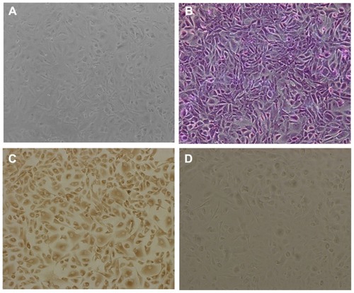 Figure 4 Morphology of cultured hRPE cells. (A) primary cultured hRPE cells, (B) Giemsa staining hRPE cells, (C) immunocytochemical staining hRPE cells, and (D) hRPE cells lacking immunohistochemical staining in control preparation (×100).Abbreviation: hRPE, human retinal pigment epithelial.