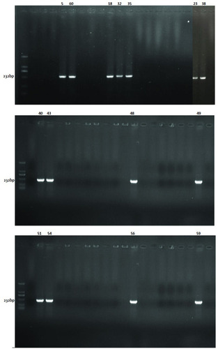 Figure 1 Detection of IMP genes of carbapenem-resistant Acinetobacter baumannii clinical isolates by PCR.