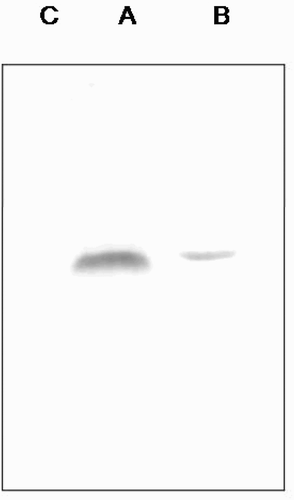 Figure 6. Western blot of transgenic line showing reduced level of virus accumulation in their systemic leaves (b) as compared to their inoculated leaf (a) at 25 dpi.