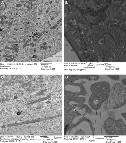 Figure 7 Magnified TEM of organelles and rSeNPs in HNSCC and HDF cell lines.Notes: Magnified TEM of organelles in (A) HNSCC cell line SCC-9 and (C) HDF cell line CC-2509, untreated and stained. Magnified TEM of organelles and rSeNPs in (B) HNSCC cell line SCC-9 and (D) HDF cell line CC-2509, treated and unstained. Bright white dots may be selenium nanoparticles.Abbreviations: TEM, transmission electron microscopy; rSeNPs, red-allotrope selenium nanoparticles; HNSCC, head and neck squamous cell carcinoma; HDF, human dermal fibroblast; HV, high vacuum.