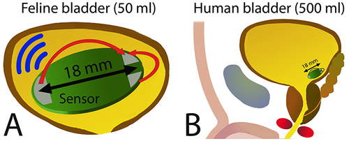 Figure 2 Volume monitoring devices: variations in electrical properties of the bladder. (A) The sensor consists of a small panel measuring 12×18 mm with three electrodes and was surgically implanted in a feline bladder and remained unanchored. The volume estimate was determined by the analysis of direct current conducted by the fluid between the electrodes (red arrows). This device could measure both bladder pressure and volume and allowed wireless transmission to a receiver. Data from McAdams et alCitation34 (B) Because the feline bladder is small (50 mL), this approach requires further studies using a larger bladder volume, such as that of humans, for which the volume is 10 times greater.