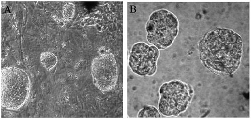 Figure 1. Phase contrast microscopy images of A) hiPSC colones on MEFs inactivated feeders B) embryoid bodies (EBs) EBs in hanging culture medium (×100 magnifications).