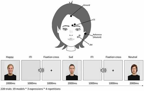 Figure 1. Schematic illustration of the study design and the positions of the electrodes assessing the activation over the ZM and CS facial muscles.