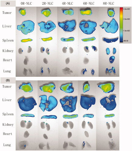 Figure 5. Tissue distribution of Dir-loaded nR-NLC in S180 tumor-bearing mice. The Dir concentration was 2.5 mg/kg. The organs were collected after the sacrifice of the mice, and the pictures were taken by the In Vivo FX PRO imaging system (Bruker, Germany) with the same exposure time, the minimum and maximum fluorescent intensity was 900 and 4000, respectively, in all the groups.