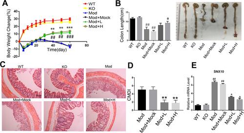 Figure 5 The effects of SRP-NPs on a chronic mouse model of IBD. (A) 40 IL10−/-mice were randomly divided into five groups with eight mice in each group: KO, Mod, Mod + Mock (3 mg/20 g MP-NPs), Mod + L (1 mg/20 g SRP-NPs), and Mod + H group (3 mg/20 g SRP-NPs).After 3 days of continuous drug administration as described above, piroxicam (200 ppm) was added to the diet for 4 days. Weight loss was measured for 60 days and expressed as the average percentage of initial body weight ± SEM. (B) The length of colons from mice was measured at day 60 after euthanasia. (C) Representative histological images of mice on the 60th day were compared. (D) Colon mucosa damage index scoring (CMDI) was assessed in a blinded fashion. (E) The mRNA expression of SNX10 of colon mucosa was measured by qRT-PCR. *P<0.05, **P < 0.01, ***P < 0.001 vs Mod+Mock group; ##P < 0.01, ###P < 0.001 vs KO group; n = 8 in each group.