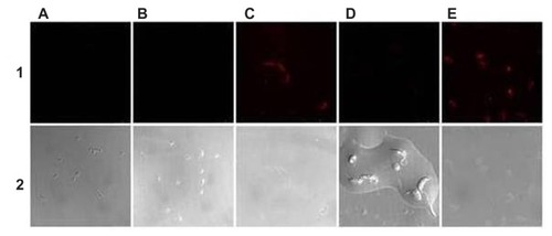 Figure 3 Laser confocal micrographs of epimastigotes of Trypanosoma cruzi incubated with different phycocyanin nanocapsules. (A) ISCOM-phy; (B) ISCOM-phy-4-A; (C) ISCOM-phy-4-A-IgGsp; (D) ISCOM-phy-7-A; (E) ISCOM-phy-7-A-IgGsp.Notes: (1) Laser confocal and (2) phase contrast microscope images.Abbreviations: IgG, immunoglobulin; IgGsp, IgG specific; ISCOM, immunostimulating complex; phy, phycocianin.