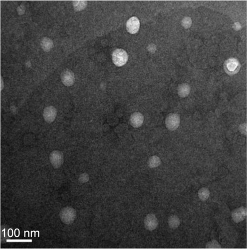 Figure 3 Transmission electron microscopy photograph of amiodarone hydrochloride-loaded liposome.