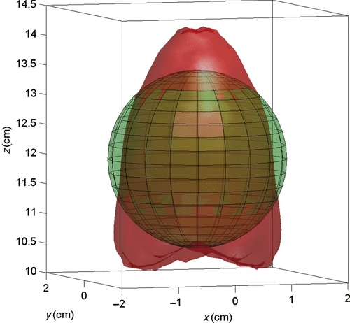 Figure 7. The 3 cm diameter tumour volume and the 42°C isothermal surface calculated in response to the power deposition obtained with waveform diversity and mode scanning, where the 13 optimal tumour control points are distributed on the back edge of the tumour and laterally about the tumour periphery in quadrant I. The 42°C isothermal surface covers 79% of the 3 cm diameter tumour, and normal tissue heating is observed along the near and far edges of the tumour relative to the centre of the array.