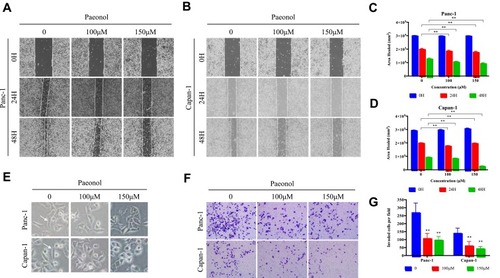 Figure 2 Paeonol suppresses the migration and invasion capacities of PDAC cells by promoting EMT. (A, B) Scratch wound-healing assay. Panc-1 and Capan-1 cells were treated with 100 or 150μΜ of Paeonol. The movement of cells into the wounds was shown at 0, 24 hrs, and 48 hrs after scratching (magnification: 100x); (C, D) Panc-1 and Capan-1 cells migration were assessed by restoring scratches and the reduction in the area of the initial scratches were compared. All results are representative of three independent experiments. **P<0.01, as compared Paeonol (100 or 150μΜ) with the non-treated control group; (E) Morphological changes in Panc-1 and Capan-1 cells after 48 hrs of culture with Paeonol (100 or 150μΜ). Arrows indicate cell shapes representing mesenchymal phenotypes; (F) The effect of Paeonol (100 or 150μΜ) treatment for 48 hrs on Panc-1 and Capan-1 cells was detected by chambers assays (magnification: 40x); (G) Histogram, based on five random fields selected for statistical analysis, shows the number of invaded cells. Data are shown as mean ± SD of three independent experiments. **P<0.01.