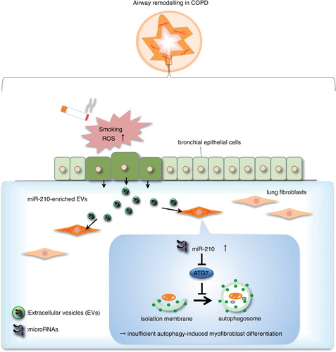 Fig. 5.  Proposed novel airway remodelling model for bronchial epithelial cells and fibroblast crosstalk in COPD.