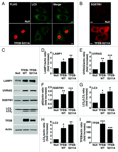 Figure 5. TFEB-S211A induces accumulation of autophagosomes. Immunofluorescence confocal microscopy showing autophagosome accumulation (A) and increased cytosolic SQSTM1 (B) in ARPE-19 cells overexpressing TFEB-S211A. (C) Immunoblotting of ARPE-19 cell lysates infected with either adenovirus Null or adenovirus expressing TFEB-wt or TFEB-S211A. Protein bands were detected using the indicated antibodies. (D–I) Quantification of protein bands as shown in (C). Bars represent the ratio of LAMP1/actin (D), UVRAG/actin (E), SQSTM1/actin (F), LC3II/LC3I (G), LC3II/actin (H), and TFEB-Flag/actin (I) expressed as fold increase of the ratio from cells infected with adenovirus Null. Values are means ± SD of three independent experiments. Scale bar: 10 μm. ***p < 0.001, **p < 0.01, *p < 0.05.