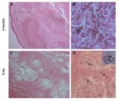 Figure 3 Histopathological characteristics of focal lesions in Xid mice 4 and 8 months post-costimulation; H&E. Larger and irregular lesions of the footpad (A, 100x) with high numbers of thin, small hyphae, conidia and conidiogenous cells (B, 400x) four months post-infection. Small and well-organized granuloma-like lesions (C, 100x) with a small number of sclerotic-like cells (D, 200x and insert 1000x) were observed after eight months.