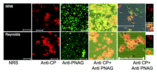 Figure 1. Reactivity of S. aureus CP8 strain MN8 and CP5 strain Reynolds to antibody to either the homologous CP antigen (Anti-CP), PNAG (Anti-PNAG) or both as detected by immunofluorescence. NRS = normal rabbit serum. Binding of rabbit antibody to CP5 or CP8 to S. aureus cells detected with anti-rabbit IgG secondary antibody conjugated to AlexaFluor (AF) 588 (red). Human mAb F598 to PNAG directly conjugated to AF 488 (Green) was used to detect PNAG on the bacterial surface. Co-localization of red and green pixels in samples reacted with antibody to both CP and PNAG antigens appears as an orange-yellow to yellow color. Far right panels show fluorescence in the individual red (Anti-CP), green (Anti-PNAG) or both channels for selected bacterial cells in the micrograph co-stained with antibody to CP and PNAG antigens. White bars = 10 µm.