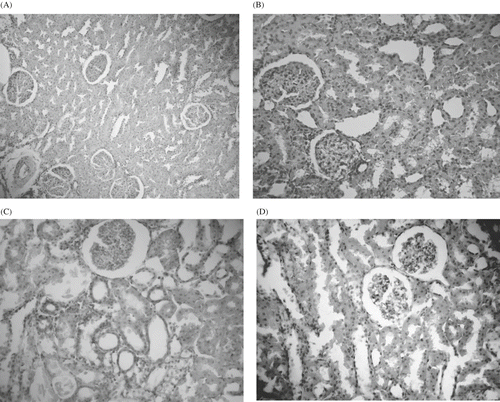 Figure 1. Control group. Kidney tissues were normal in control, H-E × 66. (B): Pentoxyphiline (PTX) group showed no significant differences from the normal histological structure of the kidney tissue, H-E × 66. (C): Amikacin (AK) group. There were significant histopathological changes in renal tissues of AK (Figure 1B), which include hydropic degeneration in proximal and distal tubule epithelial cells, glomerular congestion, sclerosis in some glomerules, tubular dilatations, congestion in peritubular capillaries, hemorrhage in some regions, mononuclear cell infiltrations in parenchyme and connective tissue increment, H-E × 66. (D) AK + PTX group. Kidney tissues were normal in control. H-E × 66.