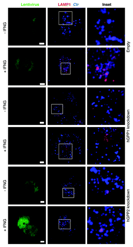 Figure 4. IFNG stimulation increased acidification of chlamydial early inclusions, but not in hGBP1 or -2 knockdown macrophages. Empty (control), hGBP1 and hGBP2-stable knockdown THP1-derived macrophage monolayers were prestimulated for 24 h with 100 U/ml IFNG and then infected with C. trachomatis MOI 100 for 2 h. Confocal microscopy images of acidotropic dye LysoTracker (Red) and C. trachomatis (Blue) revealed that IFNG stimulated the acidification of chlamydial early inclusions in WT macrophages. By contrast, the acidification process is impaired in cells deficient in either hGBP1 or 2, in response to IFNG stimulation. Scale bars: 10 μm.