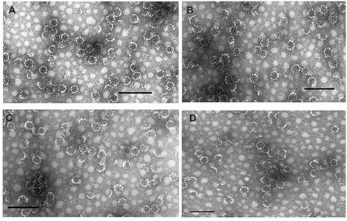 Figure 2 Transmission electron microscope images. (A) ISCOM-matrix. (B) ISCOM-phy-7-A-IgG-specific. (C) ISCOM-4-A-IgG-specific containing actinomycin D. (D) ISCOM-9-A-IgG specific IgGs.Note: Bar = 150 nm.Abbreviations: IgG, immunoglobulin; ISCOM, immunostimulating complex.