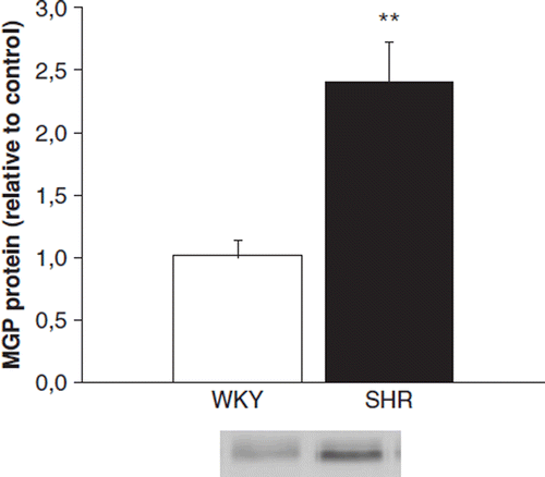 Figure 3. Western blot analysis showing matrix Gla protein (MGP) levels in 20-month-old Wistar-Kyoto (WKY) and spontaneously hypertensive rats (SHR). White columns, WKY; black columns, SHR. Results are mean±SEM, n=8. **p<0.01 vs WKY (Mann-Whitney U-test).
