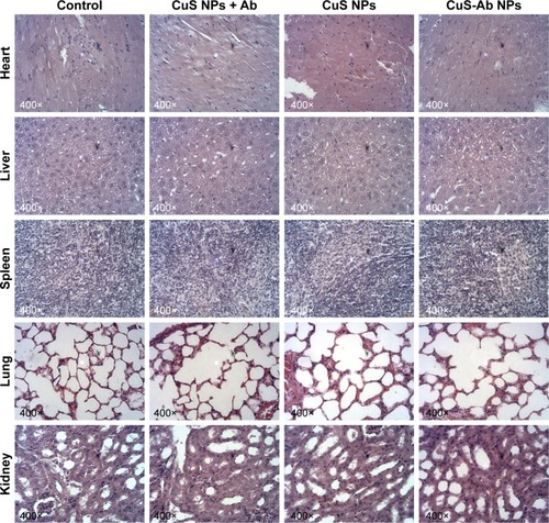 Figure 7 Light microscopy images of H&E-stained tissue sections (heart, liver, spleen, lung, and kidney).Notes: The 4T1 xenograft tumor mice were treated with CuS NPs + laser, CuS NPs + Ab + laser and CuS-Ab NPs + laser for 2 weeks. Then, all mice were killed and major tissues were collected.Abbreviations: CuS NP, CuS nanoparticle; CuS-Ab NP, cetuximab-modified CuS NP.