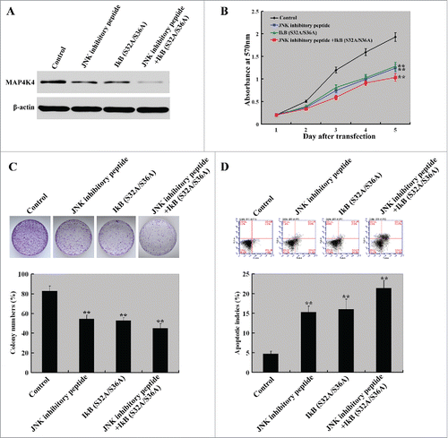 Figure 6. Inhibition of JNK and NF-κB signaling exerts anti-growth effects on HCC cells. MHHC-97H cells were transfected with the IκB (S32A/S36A) plasmid with or without pretreatment with the JNK peptide inhibitor L-stereoisomer (10 µM) and tested for cell proliferation, colony formation, and apoptosis. (A) Western blot analysis of MAP4K4 protein levels in MHHC-97H cells transfected with the plasmid IκB (S32A/S36A) or treated with L-stereoisomer. Representative blots of 3 independent experiments are shown. (B) Cell proliferation detected by the CCK8 assay. The proliferation of MHHC-97H cells was significantly inhibited by the delivery of IκB (S32A/S36A) and L-stereoisomer, either alone or in combination. (C) Colony formation was examined after 10-day incubation. Bar graph (bottom panel) represents quantification of colonies containing >50 cells. Data represent the means ± SD of 3 independent experiments. (D) Apoptosis detection by Annexin-V/PI staining. Top panel: Representative dot plots of flow cytometry analyses. Bottom panel: Quantification of apoptotic cells from 3 independent experiments. **, P< 0.01.