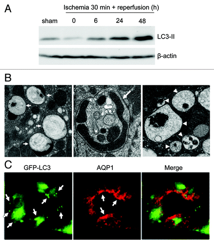 Figure 3. Autophagy in acute kidney injury. (A) Immunoblot analysis of LC3-II accumulation in kidney tissues after 30 min of bilateral renal ischemia, followed by 0 to 48 h of reperfusion. The figure is adopted from Jiang et al.,Citation110 with permission from Elsevier. (B) Formation of autophagosomes and autolysosomes in tubular cells of kidney tissues during ischemia-reperfusion. Kidney tissues were fixed for EM examination of autophagosomes (left panel, arrows: double or multiple membrane structures containing cytoplasm; middle panel, arrows: undigested organelles such as mitochondria) and autolysosomes (right panel, arrowheads: single membrane structures with remnants of cytoplasmic components). The figure is adopted from Jiang et al.,Citation110 with permission from Elsevier. (C) Cisplatin-induced autophagy in proximal tubular cells in kidney tissues. GFP-LC3 transgenic mice were treated with 20 mg/kg cisplatin for 24 h to harvest kidney tissues for immunostaining of aquaporin-1 (AQP1; marker of proximal tubules). Co-localization of GFP-LC3 dots with AQP1 suggests autophagy induction in proximal tubular cells. The figure is adopted from Inoue et al.,Citation112 with permission from Springer.