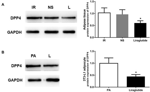 Figure 4 Liraglutide treatment reduced the expression of DPP4 in IR animal and cell models. (A) DPP4 expression was decreased by liraglutide in adipose tissues under IR conditions. (B) Liraglutide intervention in adipocytes led to decreased DPP4 expression. *P < 0.05.
