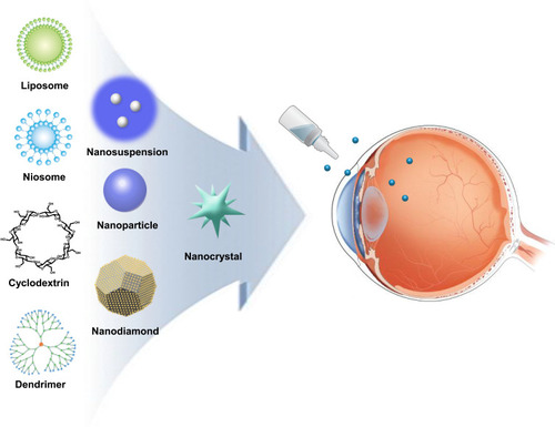Figure 2 Delivery route of nanomedicine. Topical administration of various types of nanomaterials to reduce IOP.