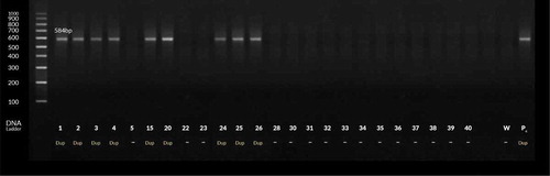 Figure 3. PCR products for H. pylori with dupA gene-based primers. Lanes 1–4 and 15, 20 and 24–26 are patients’ positive biopsy samples. Lanes Pc & W are positive (strain D0008) & negative (sterile distilled water) control, respectively.