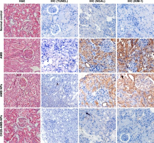 Figure 6 Nephrotoxicity assessment after different AMB formulation treatments.Notes: Normal control rats show no abnormality and no KIM-1 or NGAL expression. AMB and AMB NP treatments show high-level expression of KIM-1 and NGAL, but OX26-AMB-NP treatment shows no KIM-1 or NGAL expression. All groups of mice show no expression of apoptosis marker TUNEL under AMB therapeutic concentration (×200).Abbreviations: AMB, amphotericin B; H&E, hematoxylin and eosin stain; IHC, immunohistochemistry; KIM-1, kidney injury molecule-1; NGAL, neutrophil gelatinase-associated lipocalin; NP, nanoparticle; OX26, TfR monoclonal antibody of rats; TfR, transferrin receptor; TUNEL, terminal deoxynucleotidyl transferase-mediated dUTP-biotin nick end labeling assay.