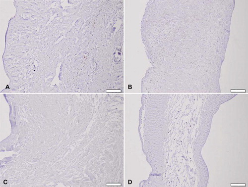 Figure 7. Immunohistochemical CD8 + T lymphocyte staining seven days after implantation of (A) trypsin, (B) osmotic, (C) trypsin-osmotic, and (D) detergent-osmotic treated matrices. Only trypsin (A) and detergent-osmotic matrices (D) show some CD8 + T-lymphocytic infiltration. Scale bar 100μm.