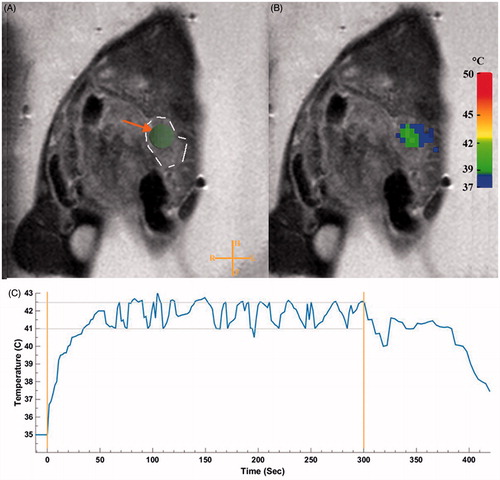 Figure 2. Planning and temperature mapping for image-guided hyperthermia. The KPC tumour was identified on the planning images in the tail of the pancreas (A). The ROI was placed in the centre of the tumour. A dashed line to outline the tumour has been added to show the reader the tumour border. Real-time MRI-based temperature monitoring using the PRFS method shown in colour overlaid on the planning image (B). Representative mean temperature in the target region during a sonication (C). Stable mild hyperthermia was achieved in the target region through binary feedback control of temperature. An algorithm was utilised to keep the temperature in the range of 41–42.5 °C (horizontal lines) within the ROI (4 mm diameter). Orange vertical lines represent the start and end of the sonication.