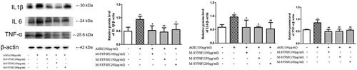 Figure 9. The effect of M-SYFSF on inflammation in HK-2 cells. Western blot analysis of IL1β, IL 6, and TNF-α, n = 3. *p < 0.05, **p < 0.01 compared to the control group; #p < 0.05, ##p < 0.01 compared to the model group.