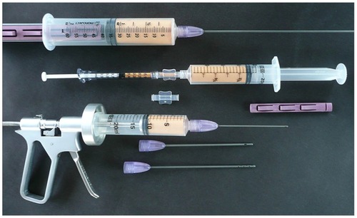 Figure 2 Complete closed-syringe microcannula system (Tulip® GEMS™, Tulip Medical Systems, San Diego, CA, USA).