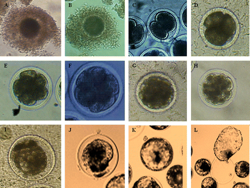Figure 1.   The photo of oocyte and embryo in different development stage for yak. A: Immature oocyte (d −1); B: Matured oocyte (d 0); C: 2-cell embryo (d 1–2); D: 4-cell embryo (d 2); E: 8-cell embryo (d 2–3); F: 8–16 cell embryo (d 3); G: >16 cell embryo (d 3–4); H: Compact Morula (d 4–5); I: Compact morula-early blastocyst (d 5–6); J: Early blastocyst (d 6–7); K: Blastocyst (d 7–8); L: Hatching blastocyst (d 8–9).