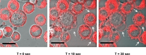 Figure 4 Time-lapse photography of SK-BR-3 cells exposed to anti-HER2 functionalized GGS-NPs and 50 mW laser power. The fluorescent red DiI membrane stain indicates regions of membrane blebbing generated by localized hyperthermia, with examples depicted by white arrows. Scale bar = 20 μm.