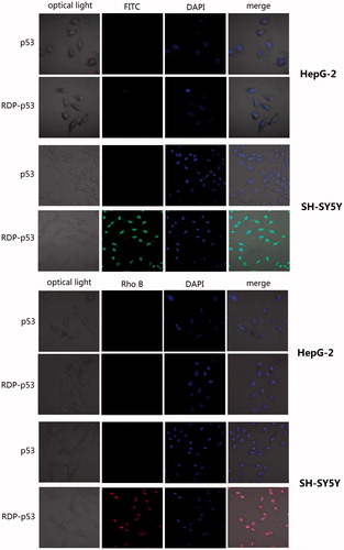 Figure 1. RDP-p53 selectively entered into the neuroblastoma cells observed under confocal microscope. HepG-2 and SH-SY5Y cells were first, respectively, incubated with FITC and rhodamine B isothiocyanate (Rho B) labeled p53 and RDP-p53 for 3 h. After washed with PBS three times, cells were stained by DAPI for 30 min and washed again. Magnification 400 × .