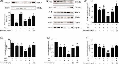 Figure 5. Kaempferol upregulated GPER and then activated PI3K/AKT/Nrf2 pathway. Changes in expression level of GPER (A), PI3K (C), Nrf-2 (E), HO-1 (F) and P-AKT/AKT ratio (D) in arterial tissue. All date was analysed with one-way ANOVA and unpaired t-test and showed as the mean ± SD. #p < 0.05, and ##p < 0.01 vs. the control group; *p < 0.05, and **p < 0.01 vs. the OVX-HFD group; ns: not significant (p > 0.05 vs. the control group) (n = 5).