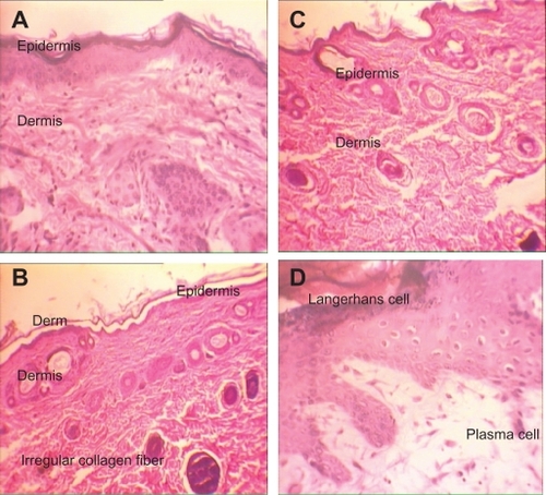 Figure 3 H&E stained skin sections in an acute toxicity study (× 40). A) Negative control; B) AgNO3 group: reduced thickness of epidermis and increased regular collagen fiber in papillary layer and mononuclear inflammation; C) Low-dose nanosilver group with reduced thickness of epidermis, reduced thickness of papillary layer, and regular collagen fibers; D) High-dose nanosilver group with reduced thickness of epidermis, reduced thickness of papillary layer, and irregular collagen fibers.