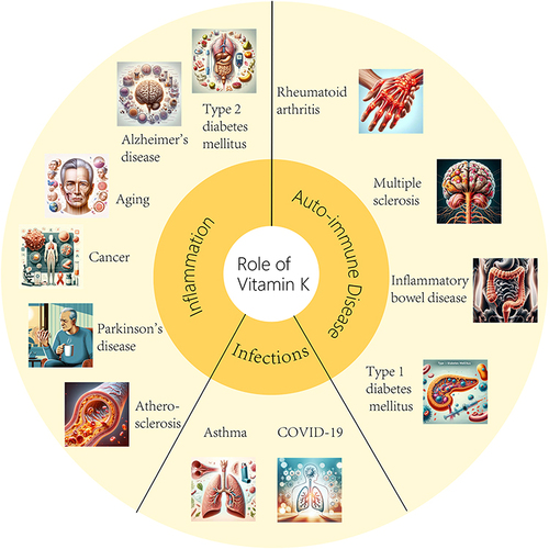 Figure 3 The positive effects of vitamin K (VK) on infections (eg, asthma, COVID-19), inflammation (eg, in type 2 diabetes mellitus, Alzheimer’s disease, Parkinson’s disease, cancer, aging, atherosclerosis) and autoimmune disorders (eg, inflammatory bowel disease, type 1 diabetes mellitus, multiple sclerosis, rheumatoid arthritis).