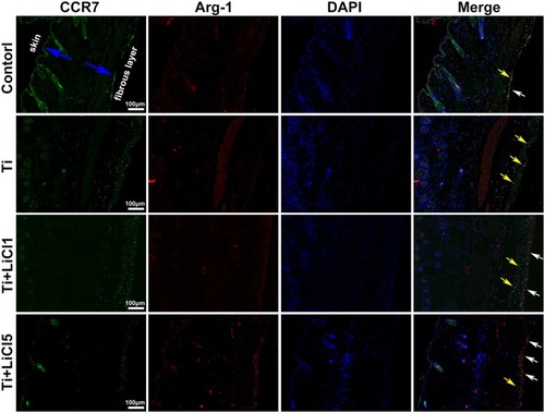 Figure 9 Images of immunofluorescence staining on air-pouch tissues at day 4.Notes: CCR7 (M1 marker) positive cells were stained in green and Arg-1 (M2 marker) positive cells were stained in red; nuclei were stained in blue; scale bar: 100 μm.Abbreviations: CCR7, C-C chemokine receptor type 7; Arg-1, arginase-1.